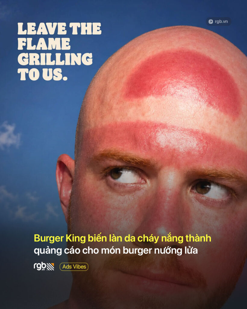 Chiến dịch quảng cáo của Burger King biến làn da cháy nắng thành quảng cáo cho món burger nướng lửa