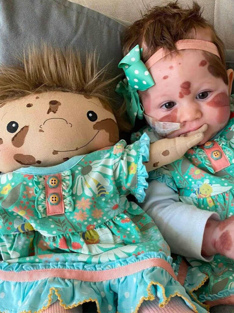A Doll Like Me - dự án tạo ra những con búp bê mang hình dáng giống các em nhỏ gặp khiếm khuyết